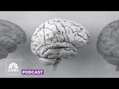 Would you get a chip implanted in your brain? 🎧