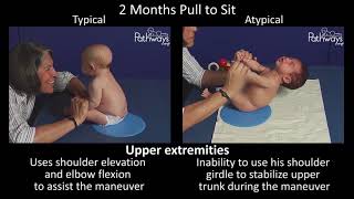 2 Month Old Baby Typical & Atypical Development Side by Side