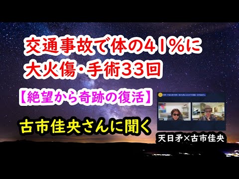 【交通事故で体の41%に大火傷・手術33回／絶望から奇跡の復活】古市佳央さんに聞く