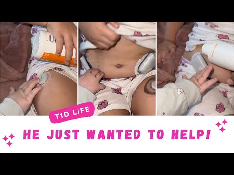 Baby Brother Rips Off Her Dexcom & Omnipod! #T1D