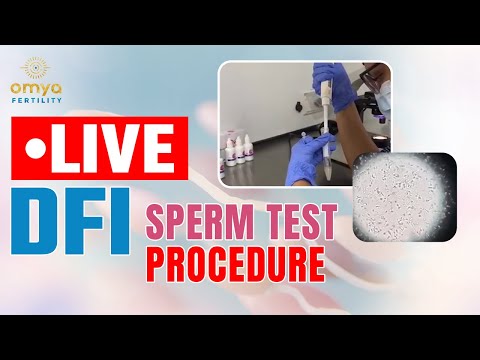 🔴Live DFI Test Procedure Step by Step | Sperm DNA Fragmentation Test | Omya Fertility | Delhi