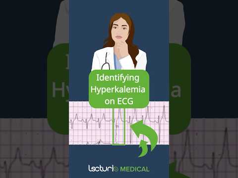 Key ECG Clues for Hyperkalemia 📊