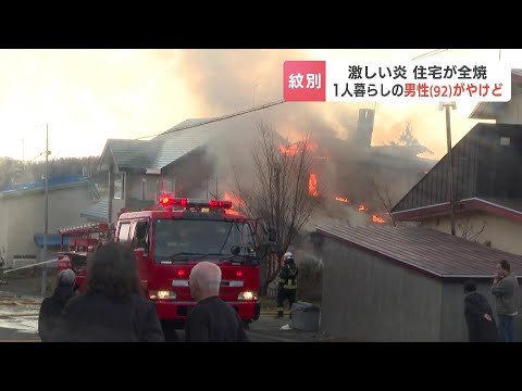 「家が燃えている」住宅火災で1人暮らしの92歳男性が背中などにやけど　１階の寝室から自力脱出　北海道紋別市