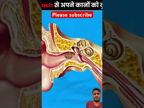 कान में घुस जाते हैं ये कोकरोच😱🪳👉👂#shorts #trending #viralvideos #amazingfacts #interestingfacts