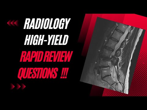 Radiology High Yield Info For Physician Assistant Students!