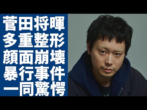 菅田将暉が突然にブサイクになった理由...顔面崩壊と言われる多重整形の真相に一同驚愕...！「日本を代表する」演技は俳優となった彼の暴行事件の真相...大物家族の正体に言葉を失う...