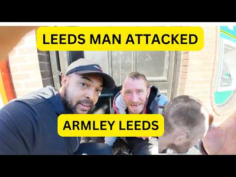 LEEDS MAN ATTACKED IN ARMLEY