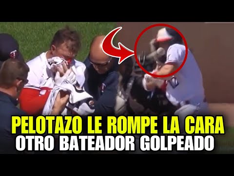 INCREÍBLE! LE ROMPEN LA CARA A OTRO BATEADOR POR PELOTAZO, TWINS VS WHITE SOX - MLB HIT BY PITCH