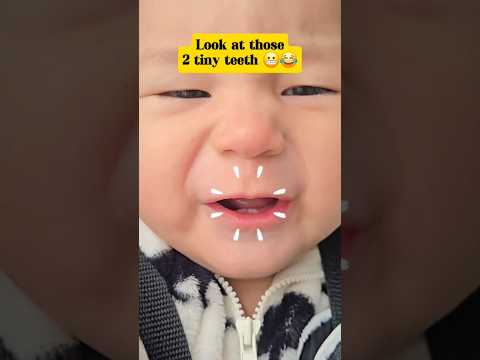 So cute baby Teeth 👶 #babyteeth #funnybaby #cutebaby #6monthsbaby #babyshorts #shortsfeed