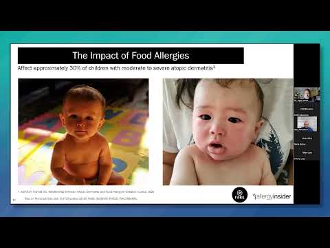 Food Allergy 101: Food Allergy Testing Basics