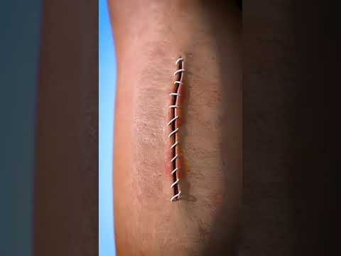 How Stitches Work 😯#tipsandtricks #shorts #lifehacks #youtubeshorts #viralvideo #tips #experiment