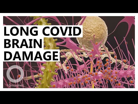 Coronavirus Brain Damage: Two Ways COVID-19 Can Cause Long COVID