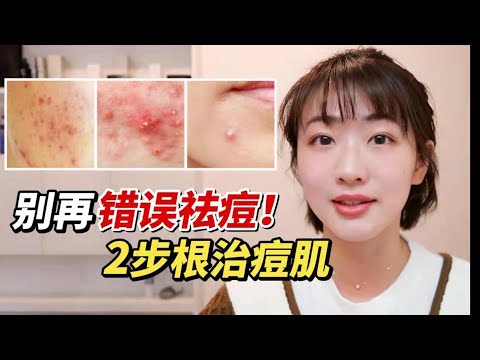 痘痘反復紅腫敏感？是你方法用錯了！內調外理全面根治痘痘肌！