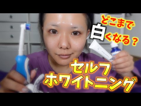 【ホワイトニング】お家で簡単歯を白くする方法ご紹介します！