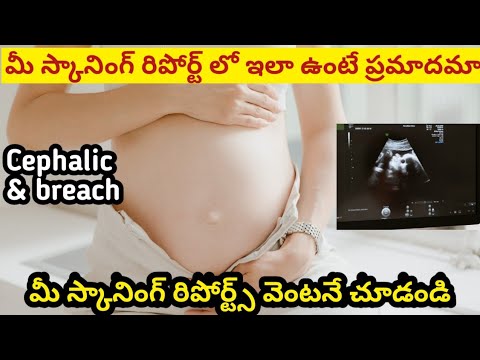 scaning during pregnancy in telugu | cephalic and breech presentation meaning||