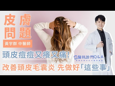 頭皮痘痘又癢又痛！要改善頭皮毛囊炎 先做好「這些事」！ | 黃宇群 中醫師 |