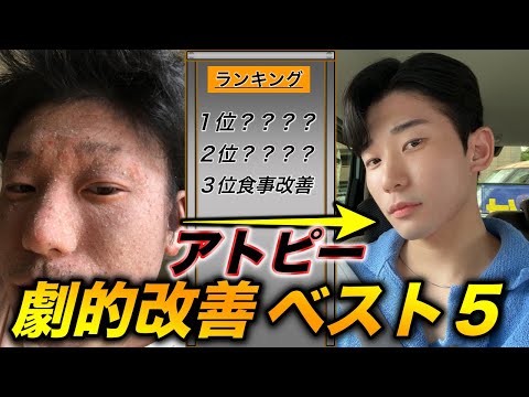 【驚愕】僕の重症アトピーを劇的に改善させたことベスト５（サプリとかじゃない）