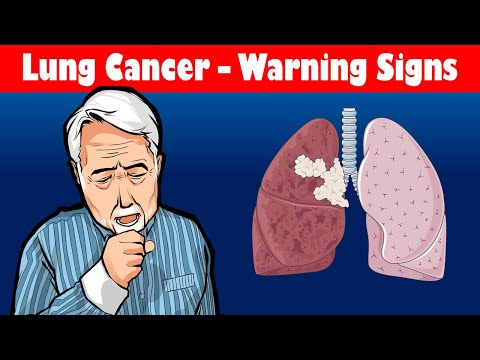 Look Out For These Symptoms, You May Be Having A Lung Cancer!!! Warning Signs Of Lung Cancer