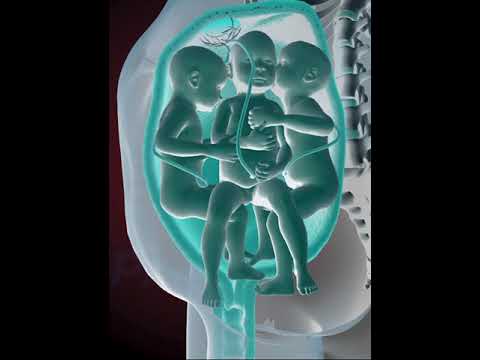 PRECIOUS MOMENTS OF TRIPLETS INSIDE THE WOMB  (3D ANIMATION)