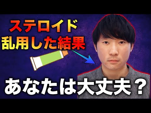 【要注意】僕が副作用を引き起こしてしまったステロイドの”悪い使用方法”を徹底解説