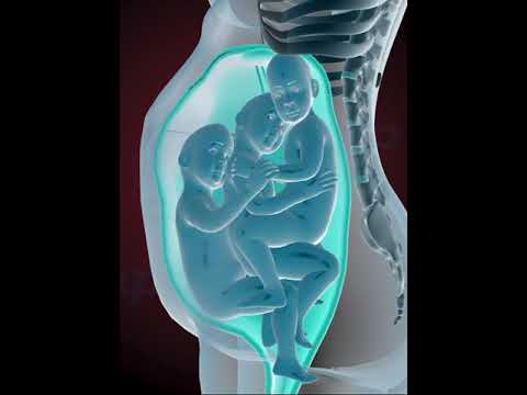 Precious moments of Triplets inside the womb (3D Animation)