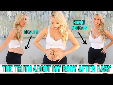 My body after baby...the truth