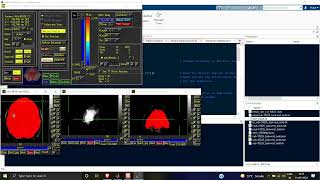 Regressing out Motion Parameters and Non Neuronal Signals | SPM | Resting-state fMRI | Preprocessing