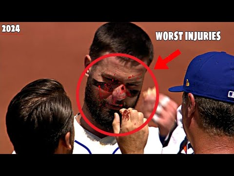 MLB• Worst Injuries Of April 2024