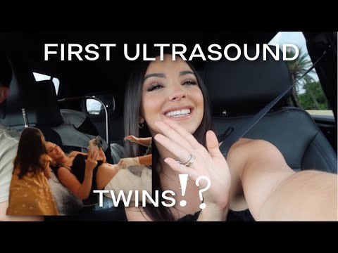 OUR FIRST ULTRASOUND FOR BABY NUMBER 5! TWINS!!?? | The Chavez Family