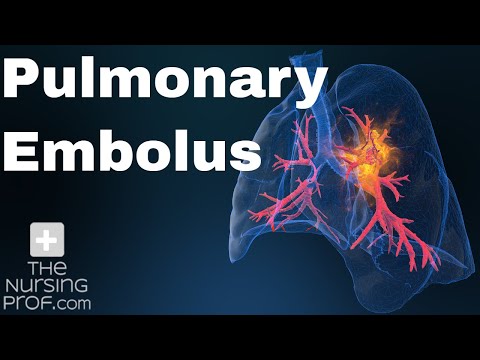 Pulmonary Embolus Nursing Care