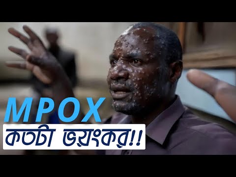 MPOX VIRUS কতটা ভয়ংকর!! | বন্যার মধ্যে আবার কোন মহামারী? | বেঁচে থাকার উপায় কি? | VOICE OF KHULNA