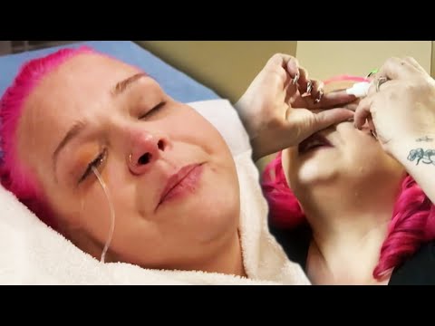 Woman Accidentally Uses Nail Glue Instead of Eye Drops