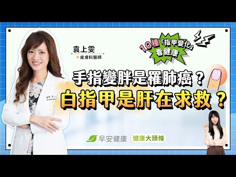 手指變胖是罹肺癌？白指甲是肝在求救？ 1０種「指甲變化」藏健康危機︱袁上雯 皮膚科醫師【早安健康X健康大頭條】