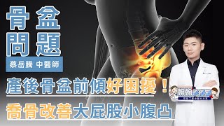 產後骨盆前傾好困擾！喬骨改善大屁股、小腹凸、腰酸背痛 | 蔡岳騰醫師 |