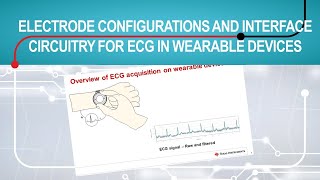 Electrode configurations and interface circuitry for electrocardiogram (ECG) in wearable devices