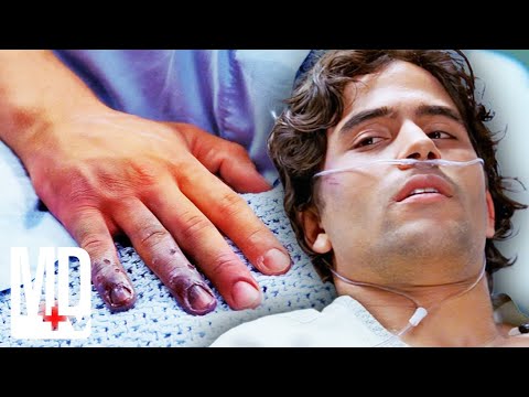 Roof Fall Leads to Life-Changing Amputation | House M.D. | MD TV