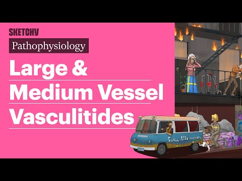 Large & Medium Vessel Vasculitides (Pathophysiology) | Sketchy Medical