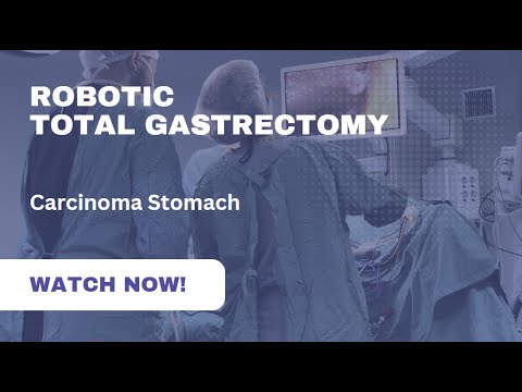 Robotic total gastrectomy with D2 lymphadenectomy