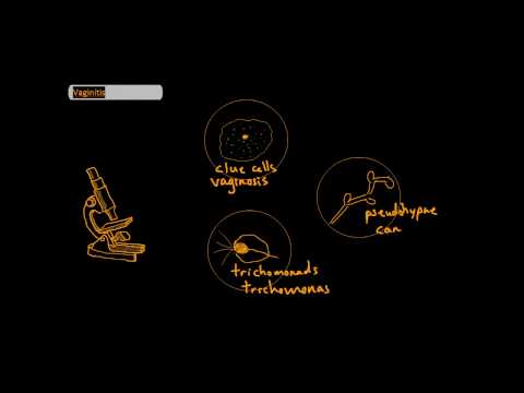 Vaginitis Differential [UndergroundMed]