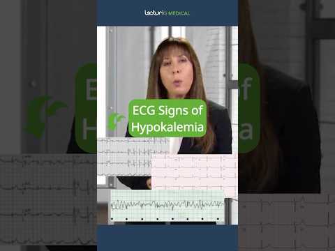 Understanding Hypokalemia 💡 Key Manifestations Explained!