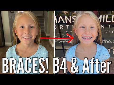 She's Getting Braces! | 8 Year Old Goes to the Orthodontist to Get Braces Put On