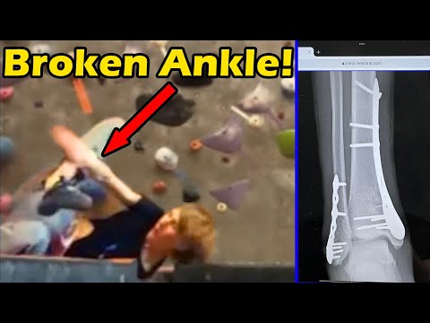 The Most Dangerous Move in Rock Climbing - Dynology #012