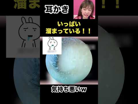 Earwax removal that becomes a habit