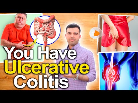 SYMPTOMS OF ULCERATIVE COLITIS YOU SHOULDN'T IGNORE - How To Recognize And Reverse It Naturally