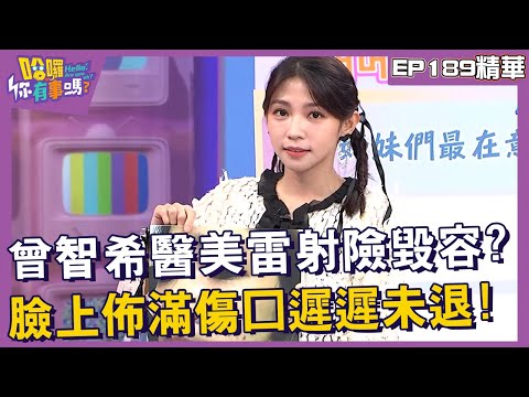 【精華】曾智希醫美雷射險毀容？臉上佈滿傷口遲遲未退！︱EP189👋20241021︱#哈囉你有事嗎